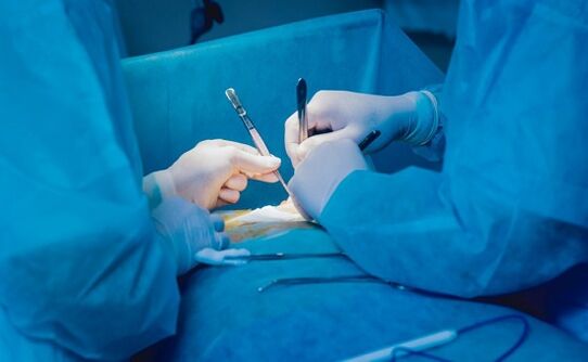 eseguire un intervento chirurgico di ingrandimento del pene